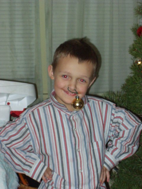 This is a picture of the red-eyed-gold-ball-nose-boy! A VERY rare picture :) lol