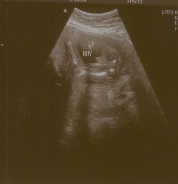 Yes...it's a BOY! (7.20.06)