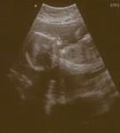 Looks like Elijah and Abigail's ultrasound picture!