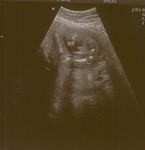 Yes...it's a BOY! (7.20.06)